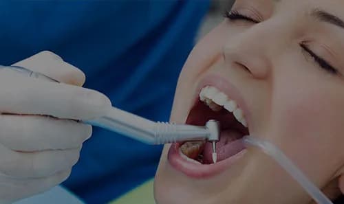 Czego nie jeść po wizycie u dentysty? Unikaj tych produktów, by nie zaszkodzić zębom!